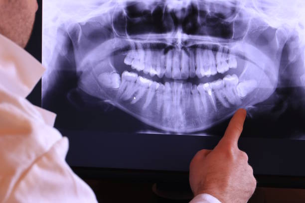Best Emergency Dental Care for Broken or Chipped Teeth in Lake Fenton, MI