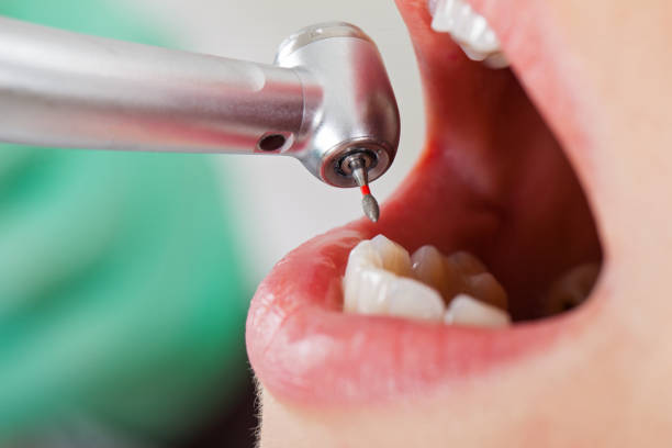 Best Emergency Denture Repair in Lake Fenton, MI